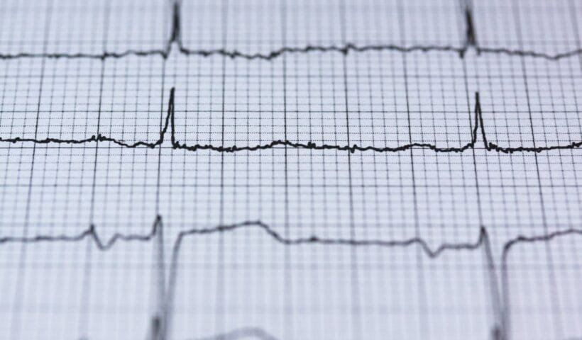 blur chart check up curve